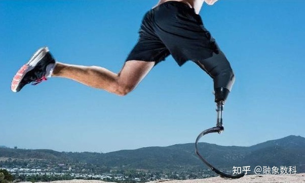 假肢與矯形器制造行業的未來發展趨勢