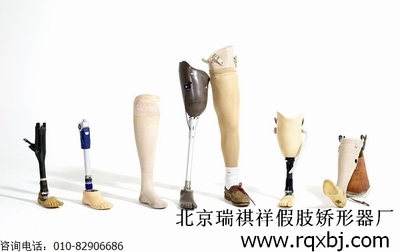 為大腿截肢者選擇適合的假肢與矯形器 從評估到適配的完整指南